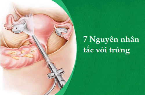 7 nguyên nhân tắc vòi trứng 